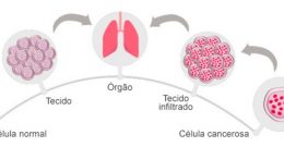 imagem que mostra a evolução do câncer nas celulas